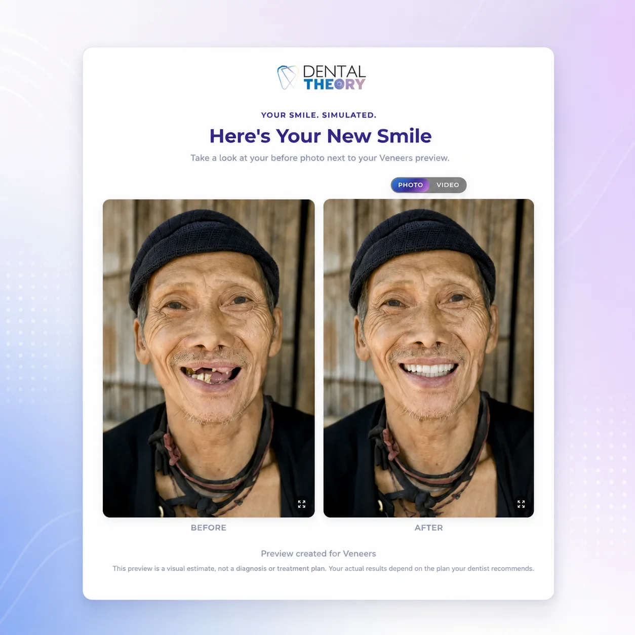 Branded patient results page with side-by-side before and after veneer previews