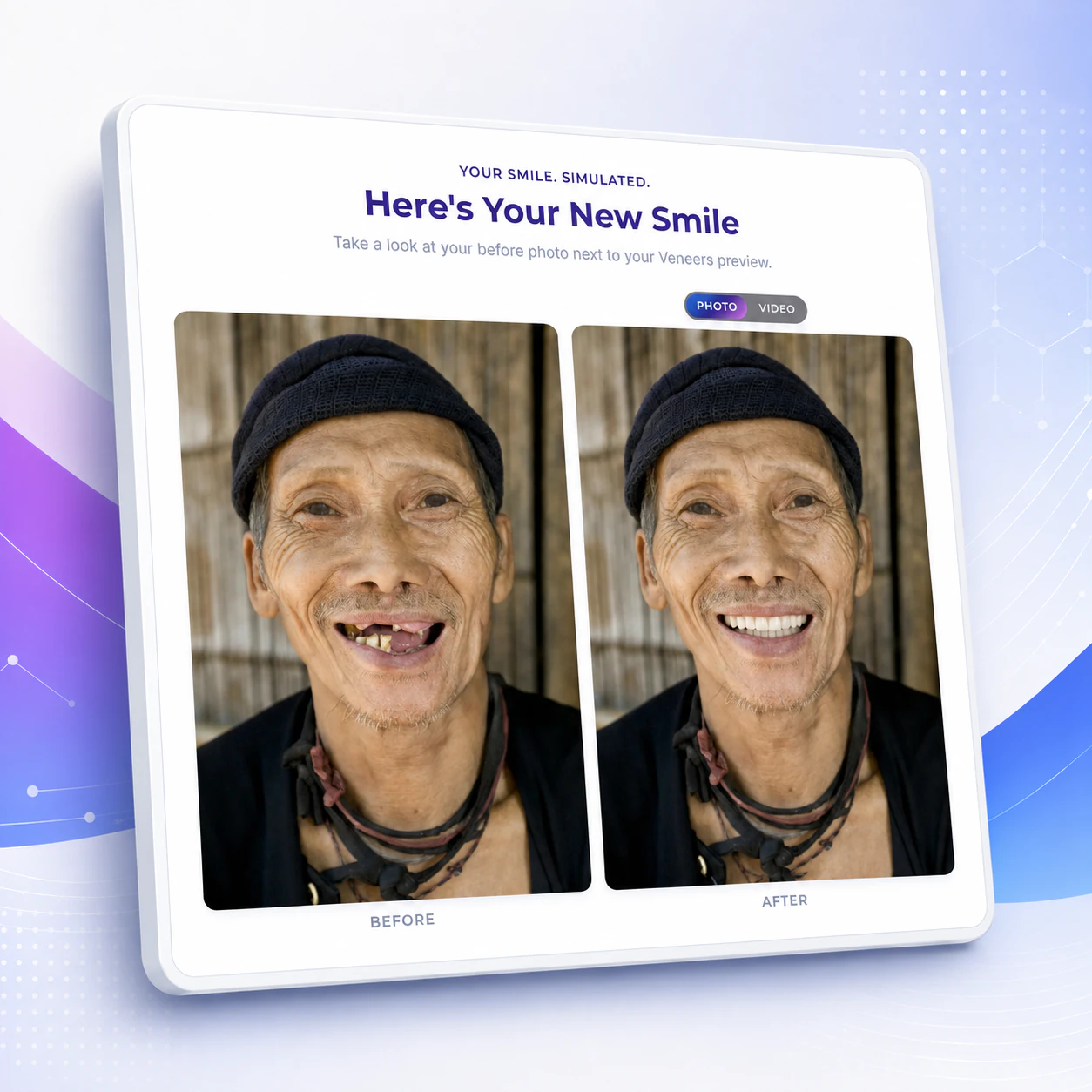 Smile Simulator result screen showing before and after smile photos