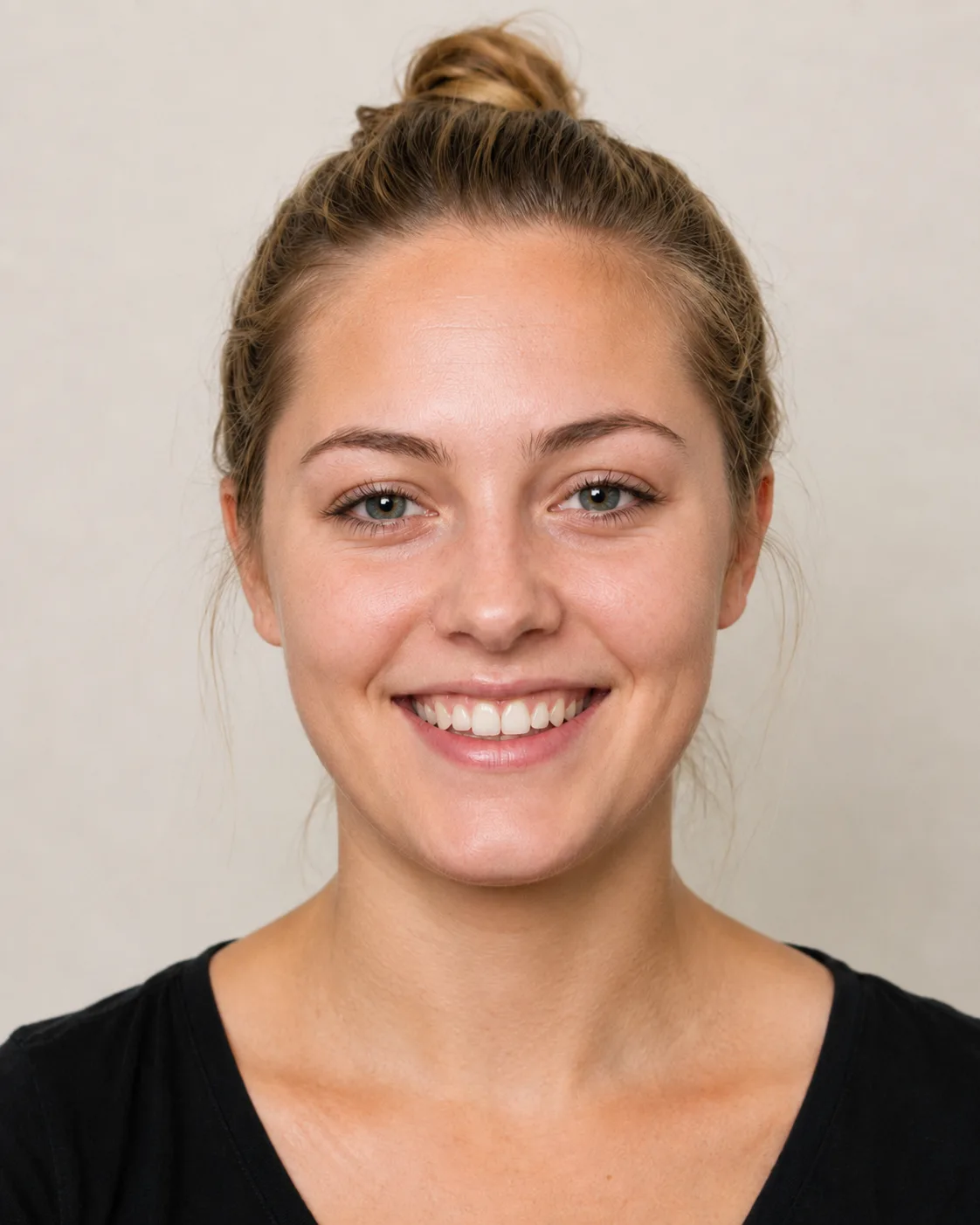 Patient smile after chipped tooth repair simulation