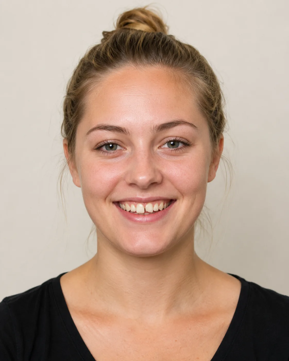 Patient smile before chipped tooth repair simulation