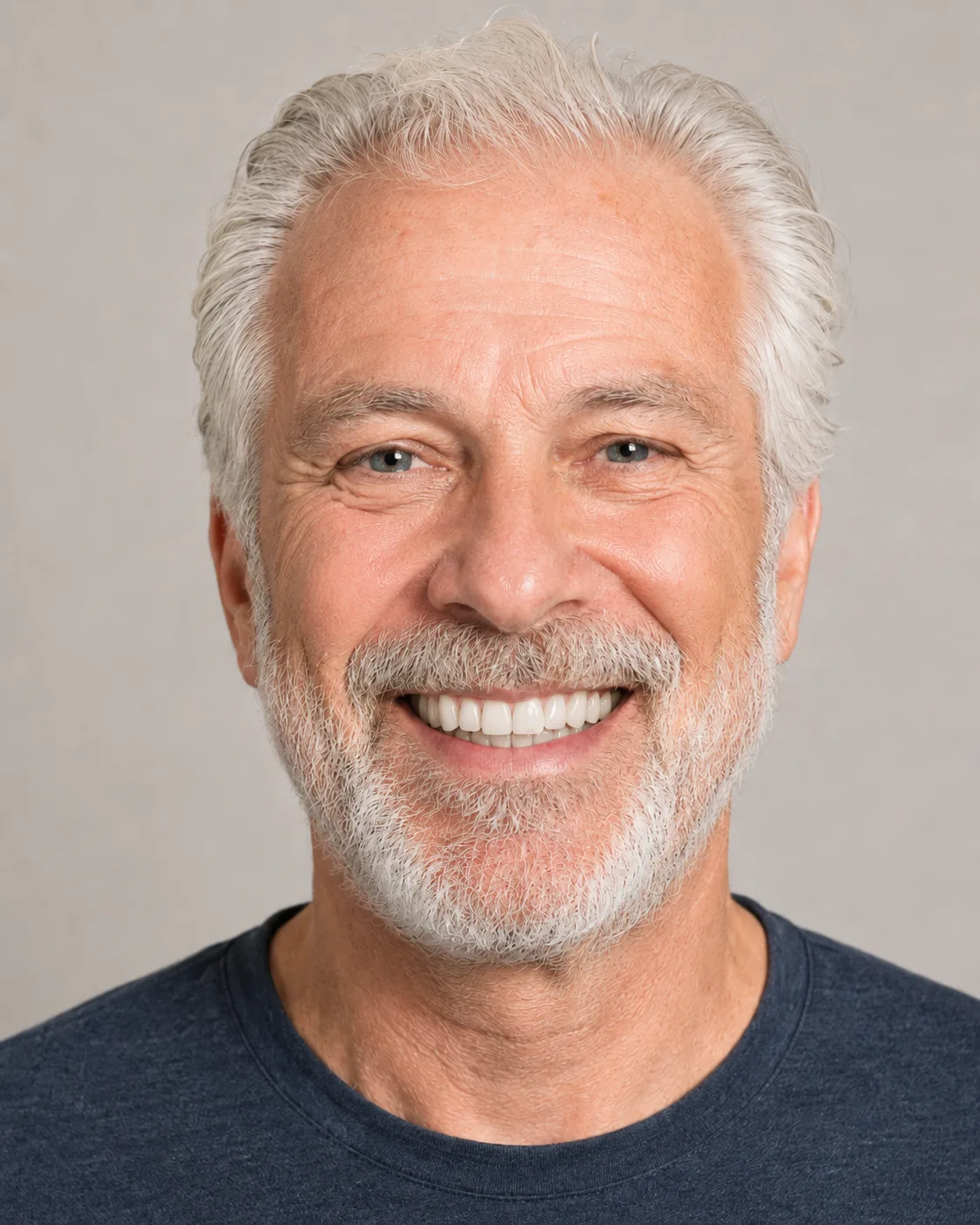 Patient smile after dental implant simulation
