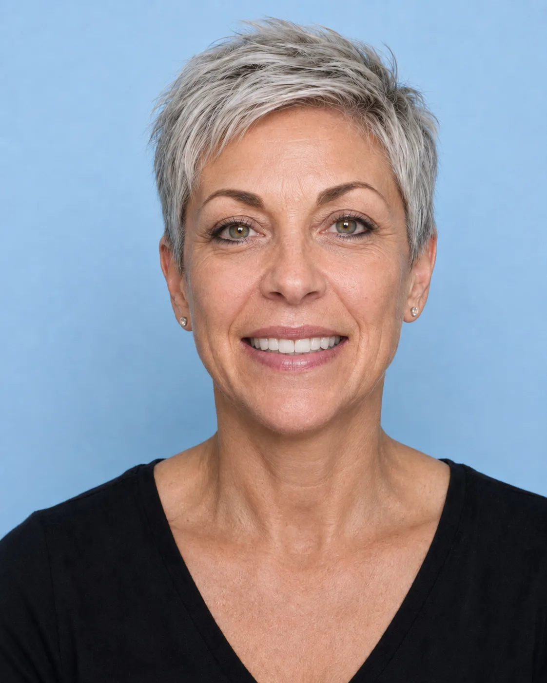 Patient smile after full mouth restoration simulation