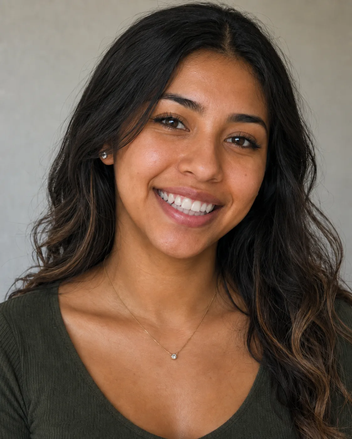 Patient smile after teeth whitening simulation, additional result