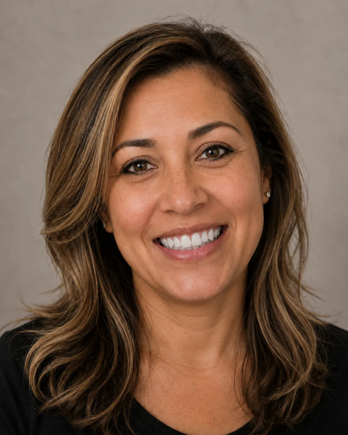 Patient smile after veneer simulation